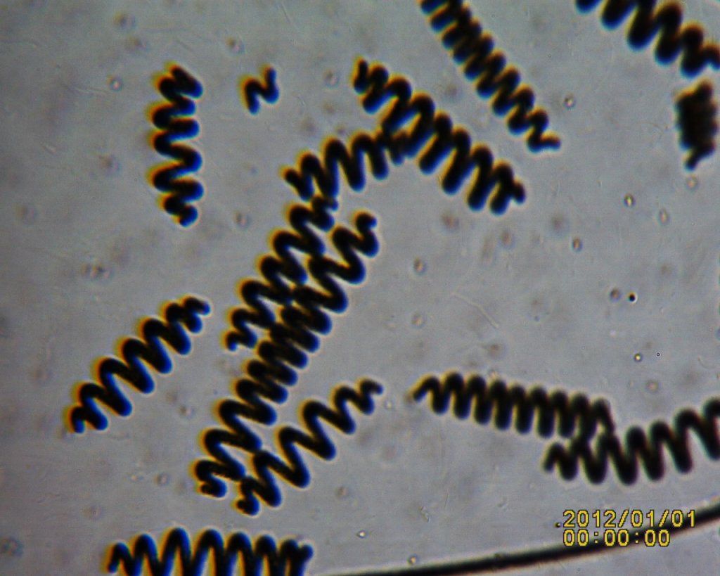 Spiruline vue au microscope